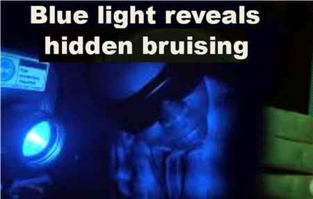 story thumbnail