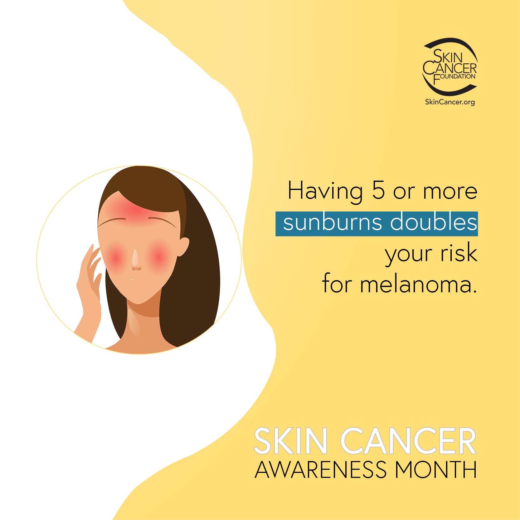 May Is Skin Cancer Prevention Month | Rotary Club of Lake Placid