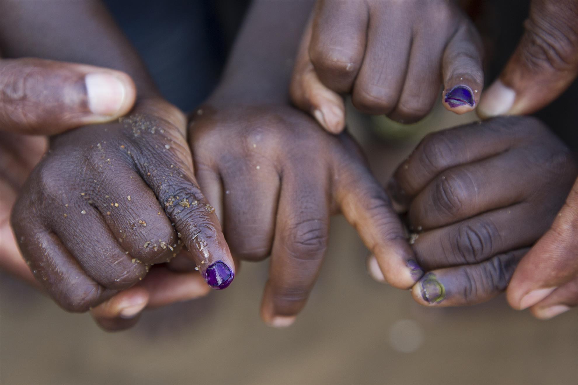 Children receive purple polish on pinkie to indicate they've been immuinized against polio