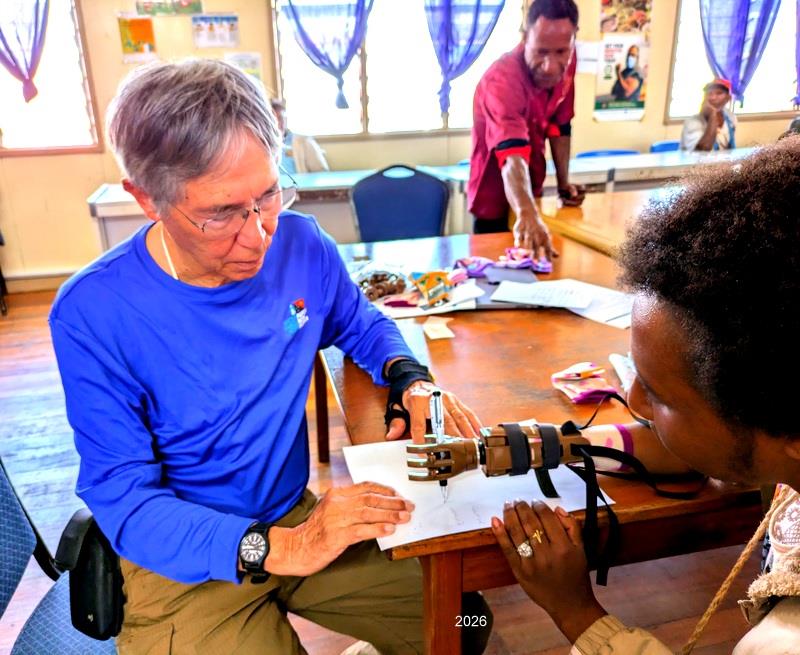 Prosthesis with Murray